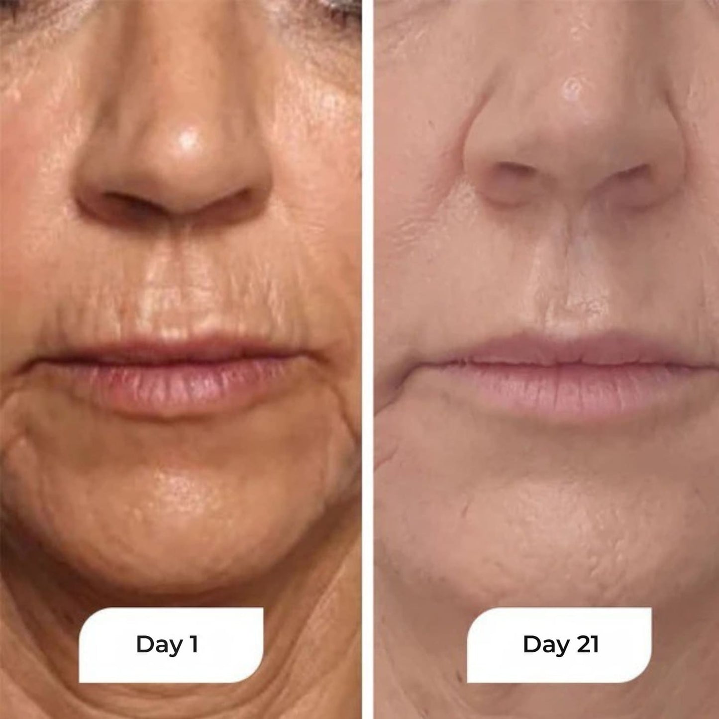 Rejuven - Anti-Aging Night Serum